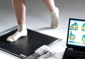 Hallux valguse diagnoosimine