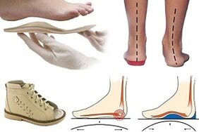 ortopeedilised kingad hallux valguse jaoks lapsel