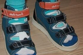 sandaalide kandmine hallux valguse jaoks lapsel